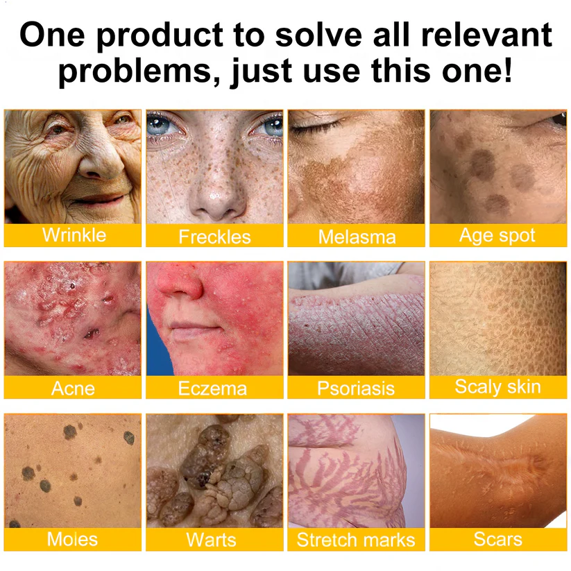 💕FDA Approved: Bee venom Pro Comprehensive Cream — 🔥Limited Time 80% OFF🔥