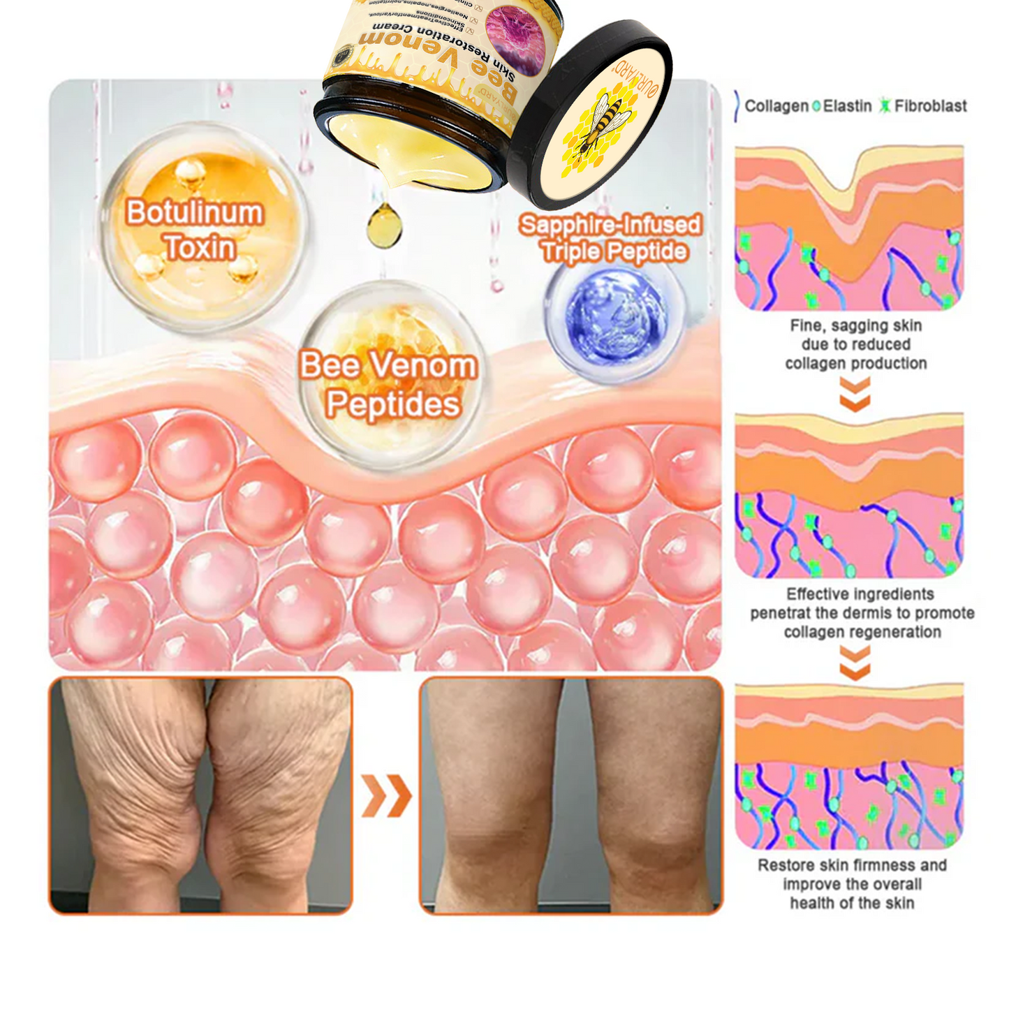 💕FDA Approved: Bee venom Pro Comprehensive Cream — 🔥Limited Time 80% OFF🔥