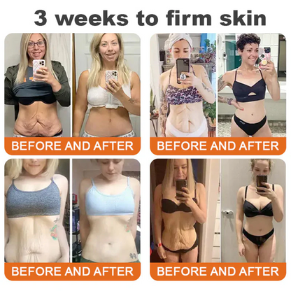 💕FDA Approved: Bee venom Pro Comprehensive Cream — 🔥Limited Time 80% OFF🔥