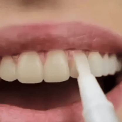 🔥Final 3 Hours: 70% OFF 🦷 SmileFitPro™ Teeth Whitening Pen – A Brighter Smile in Just Minutes